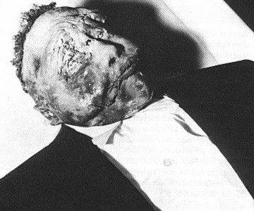 Emmett Till