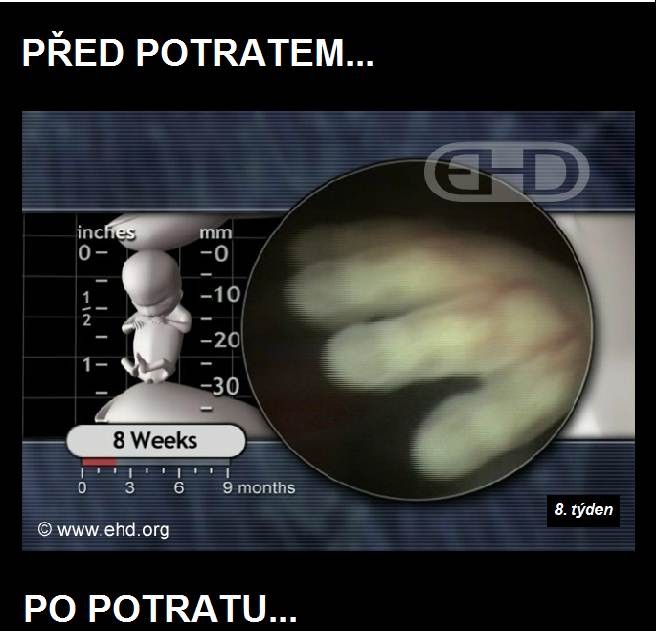 pppp81